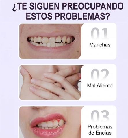 YASENSHI GEL BLANQUEADOR DENTAL - ✨ Recupera el brillo de tu sonrisa y luce dientes visiblemente más blancos
